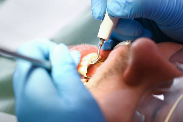 Best After-Hours Emergency Dentist in Laguna Park, TX